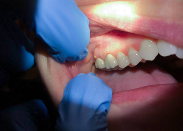 Best Emergency TMJ Treatment in Albany, TX