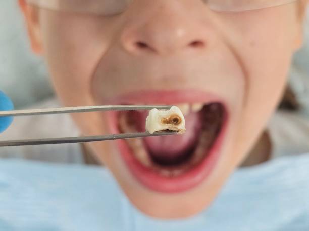 Best Emergency Gum Treatment in Albany, TX
